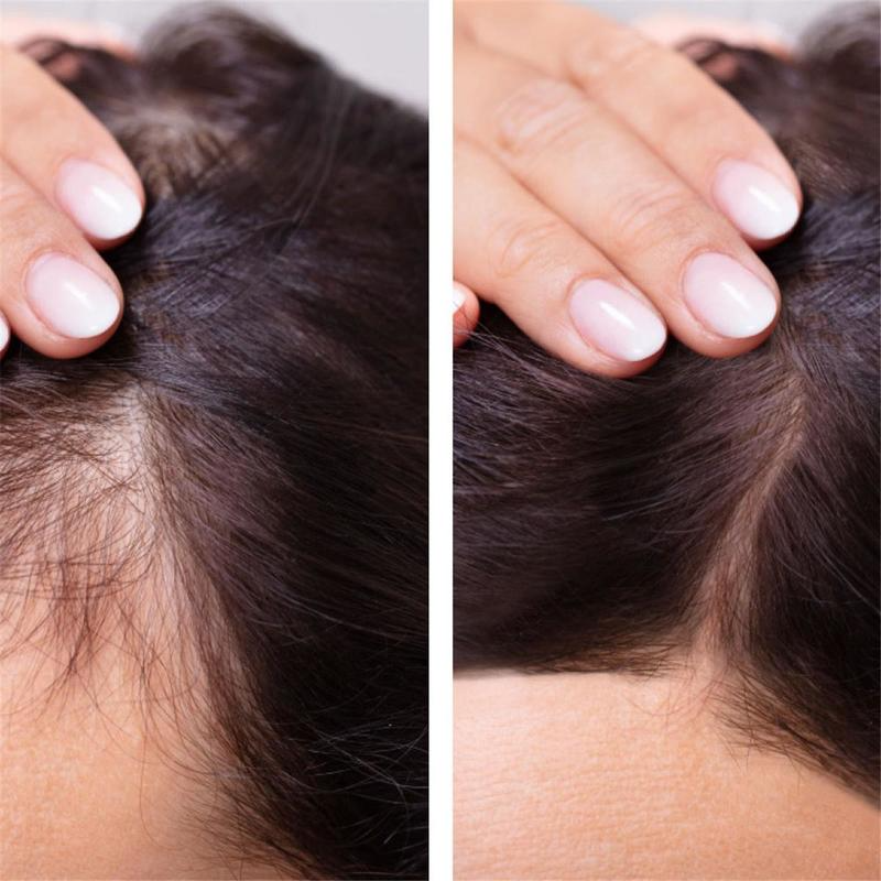 Hair Growth Serum Anti Preventing HairPliant Loss Alopecia Liquid Damaged Hair Repair Growing Faster