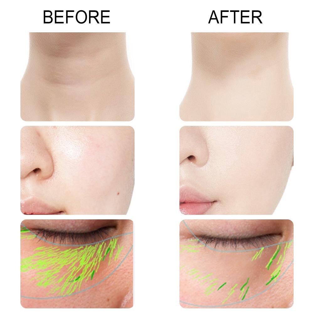 3 In 1 Face Massager Neck Facial Eye Massage Introducer Rejuvenation Beauty Aging Anti Microcurrent Skin Care Device