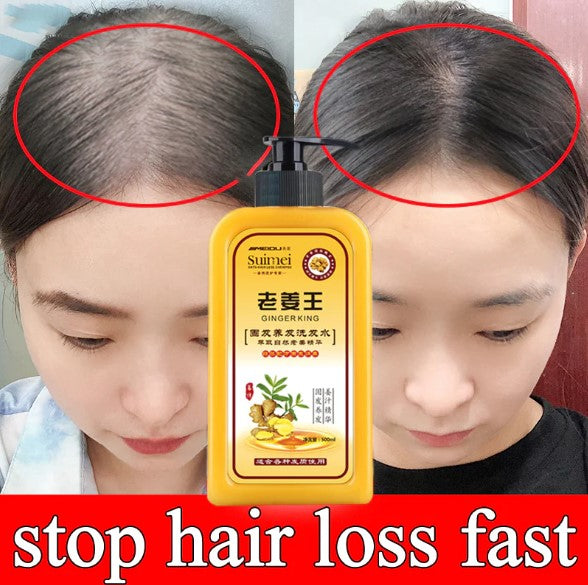 BEST SELLER! ORIGINAL GINGER SHAMPOO