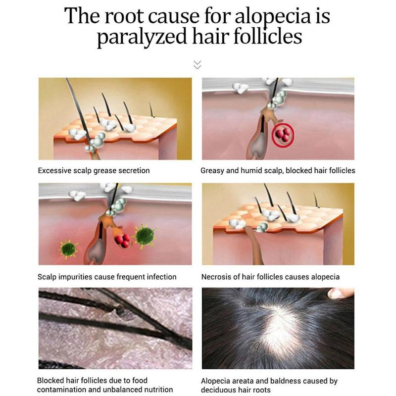Hair Growth Serum Anti Preventing HairPliant Loss Alopecia Liquid Damaged Hair Repair Growing Faster