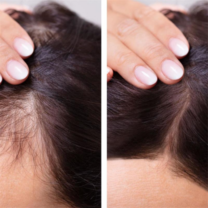 Hair Growth Serum Anti Preventing HairPliant Loss Alopecia Liquid Damaged Hair Repair Growing Faster