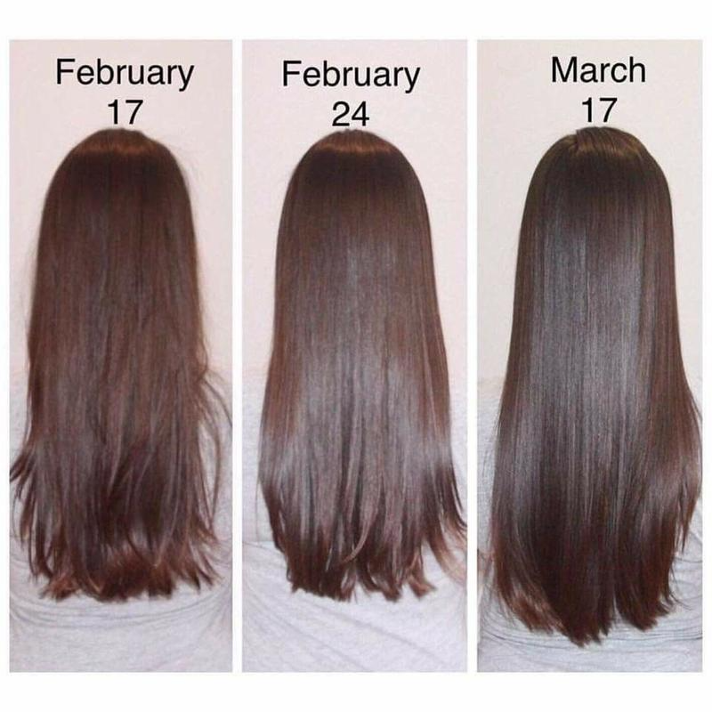 Hair Growth Serum Anti Preventing HairPliant Loss Alopecia Liquid Damaged Hair Repair Growing Faster