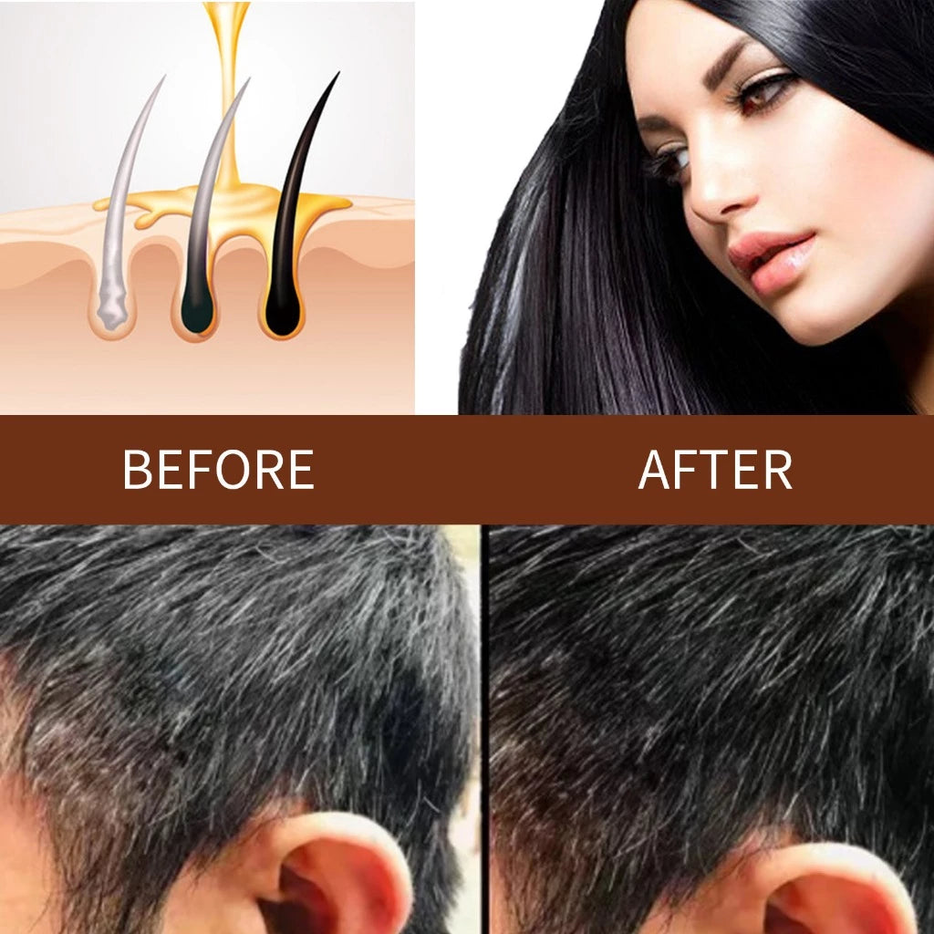 3PCS Hair Growth Soap Shampoo Polygonum Multiflorum Repair Natural Black Hair Soap 100g