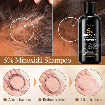 Minoxidil 5% Hair Grower Shampoo with Biotin for Hair Loss Treatment Regrowth Hair