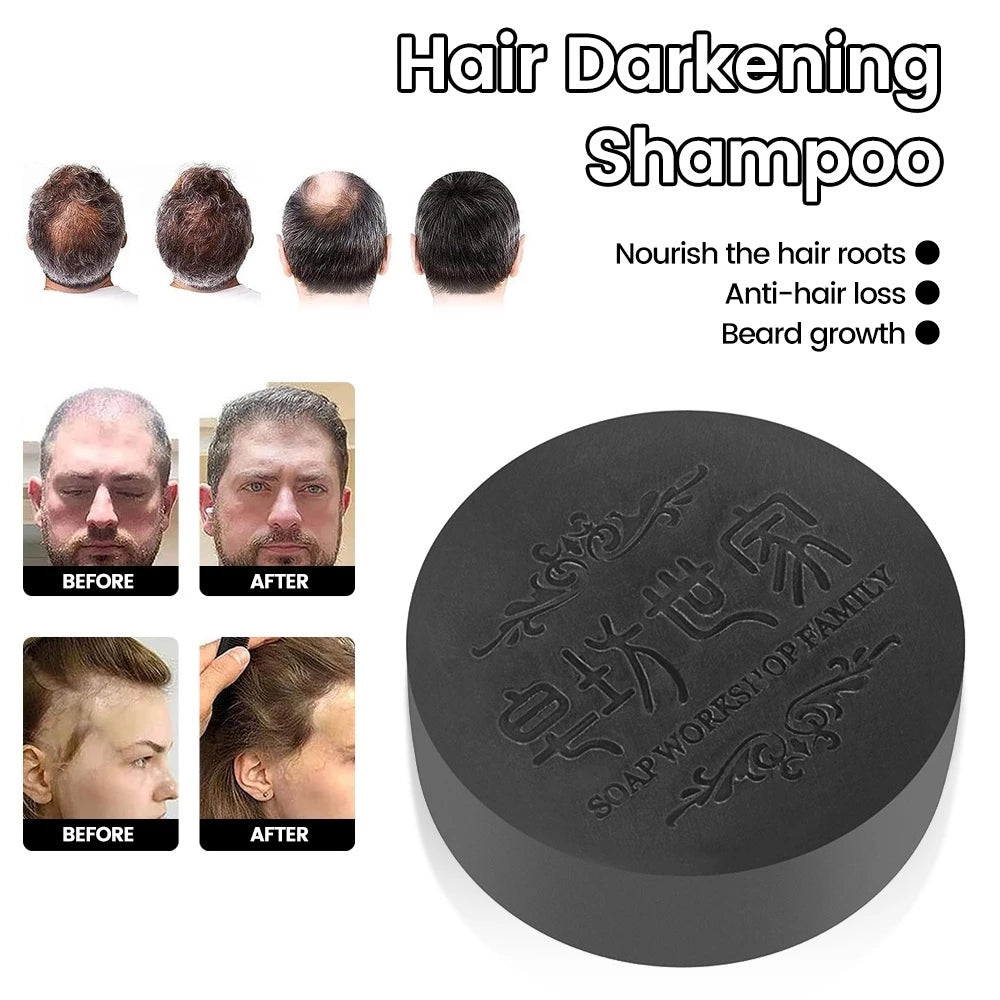 3PCS Hair Growth Soap Shampoo Polygonum Multiflorum Repair Natural Black Hair Soap 100g