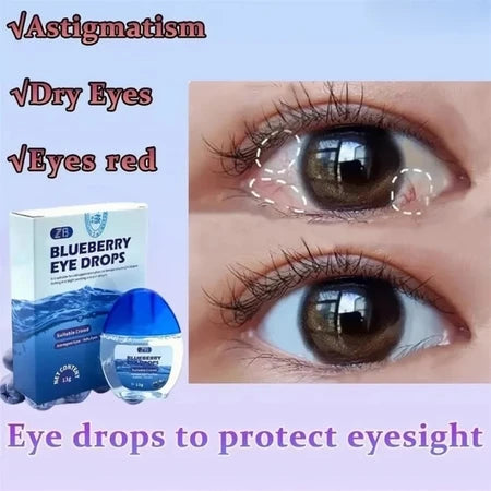 Blueberry Eye Drops 13g – Relieves Dry, Itchy Eyes, Redness, Fatigue & Blurred Vision