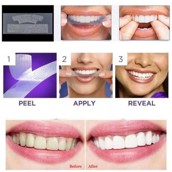 Trial Pack Teeth Whitening Strips